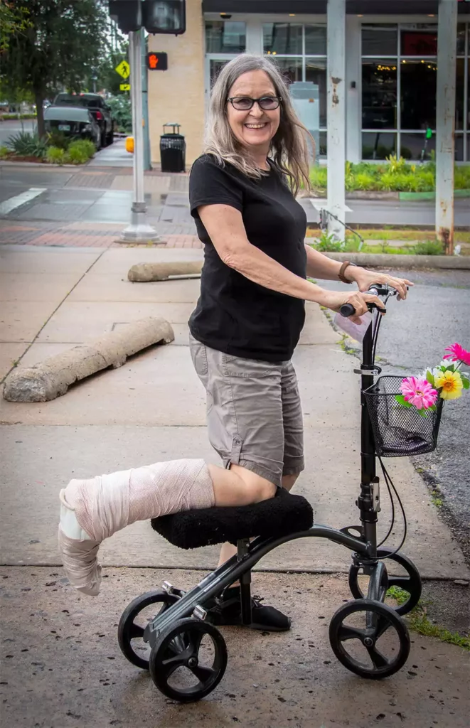 A woman with leg injury using a knee scooter